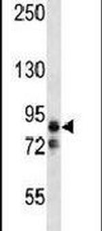 MARK2 Antibody in Western Blot (WB)