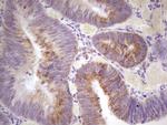 MARK3 Antibody in Immunohistochemistry (Paraffin) (IHC (P))