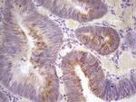 MARK3 Antibody in Immunohistochemistry (Paraffin) (IHC (P))