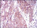 MARK3 Antibody in Immunohistochemistry (Paraffin) (IHC (P))