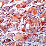 Melan-A Antibody in Immunohistochemistry (IHC)