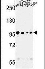 MASTL Antibody in Western Blot (WB)