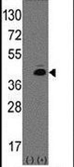 ATOH1 Antibody in Western Blot (WB)
