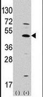 ATOH1 Antibody in Western Blot (WB)
