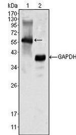 MATK Monoclonal Antibody (9D7)