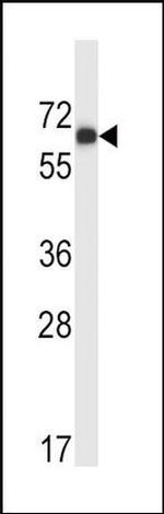 MATK Antibody in Western Blot (WB)