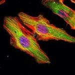 MATN1 Monoclonal Antibody (5A8)