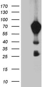 MBD1 Antibody in Western Blot (WB)