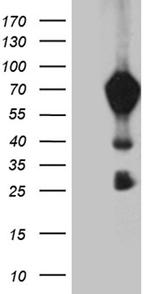 MBD1 Antibody in Western Blot (WB)