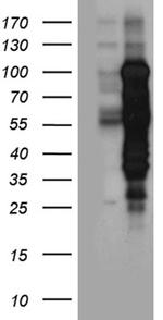 MBD1 Antibody in Western Blot (WB)