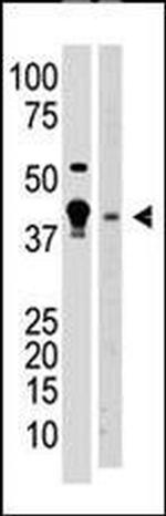 MBD2 Antibody in Western Blot (WB)