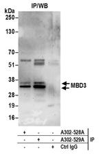 MBD3 Antibody in Immunoprecipitation (IP)