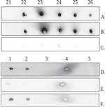 MBL2 Antibody in Dot Blot (DB)