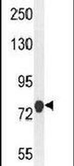 MCAF2 Antibody in Western Blot (WB)