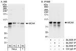 MCAK Antibody in Western Blot (WB)