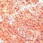 CD146 Antibody in Immunohistochemistry (IHC)
