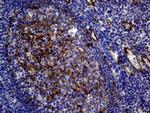 MCAM Antibody in Immunohistochemistry (Paraffin) (IHC (P))