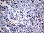 MCAM Antibody in Immunohistochemistry (Paraffin) (IHC (P))