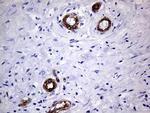 MCAM Antibody in Immunohistochemistry (Paraffin) (IHC (P))