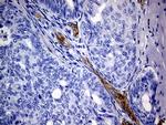 MCAM Antibody in Immunohistochemistry (Paraffin) (IHC (P))
