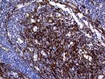 MCAM Antibody in Immunohistochemistry (Paraffin) (IHC (P))