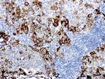 MCAM Antibody in Immunohistochemistry (Paraffin) (IHC (P))