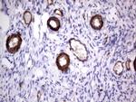 MCAM Antibody in Immunohistochemistry (Paraffin) (IHC (P))