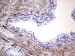MCAM Antibody in Immunohistochemistry (Paraffin) (IHC (P))