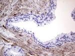 MCAM Antibody in Immunohistochemistry (Paraffin) (IHC (P))