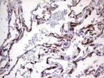 MCAM Antibody in Immunohistochemistry (Paraffin) (IHC (P))
