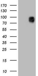 MCAM Antibody in Western Blot (WB)