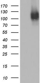 MCAM Antibody in Western Blot (WB)