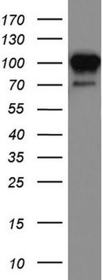 MCAM Antibody in Western Blot (WB)