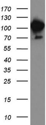 MCAM Antibody in Western Blot (WB)