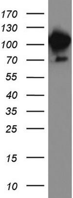 MCAM Antibody in Western Blot (WB)