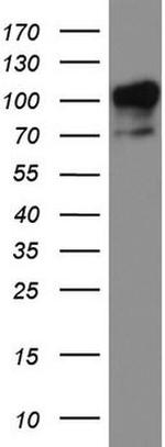 MCAM Antibody in Western Blot (WB)