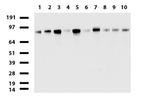 MCAM Antibody in Western Blot (WB)