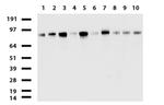 MCAM Antibody in Western Blot (WB)