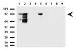 MCAM Antibody in Western Blot (WB)