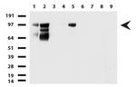 MCAM Antibody in Western Blot (WB)