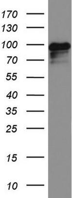 MCAM Antibody in Western Blot (WB)