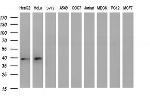 MCAT Antibody in Western Blot (WB)