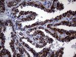 MCEE Antibody in Immunohistochemistry (Paraffin) (IHC (P))