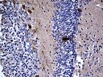 MCF2 Antibody in Immunohistochemistry (Paraffin) (IHC (P))