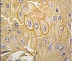 MCK10 Antibody in Immunohistochemistry (IHC)