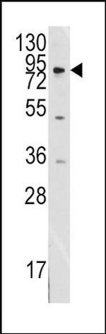 MCK10 Antibody in Western Blot (WB)