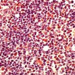 MCL1 Antibody in Immunohistochemistry (IHC)