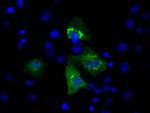 MCL1 Antibody in Immunocytochemistry (ICC/IF)