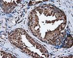 MCL1 Antibody in Immunohistochemistry (Paraffin) (IHC (P))
