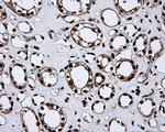 MCL1 Antibody in Immunohistochemistry (Paraffin) (IHC (P))